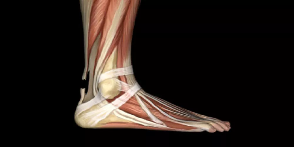 Achilles tendon reconstruction without surgery