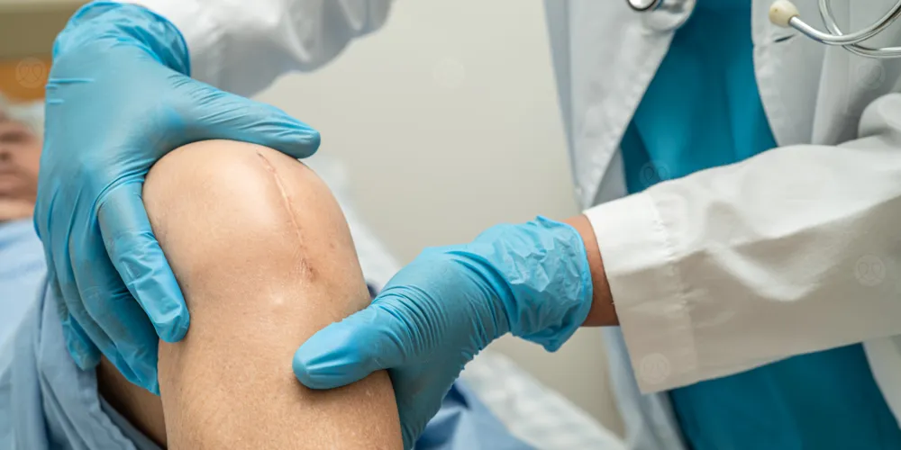 Study reveals common surgery increases knee roughness!